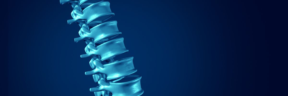 Spondilolistesi – Clinica della Colonna Motusmed Brescia