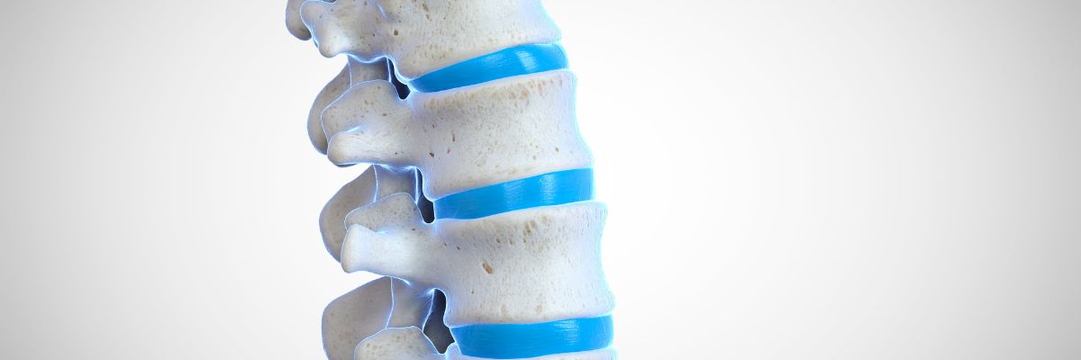 Stenosi del canale vertebrale – Clinica della Colonna Motusmed Brescia